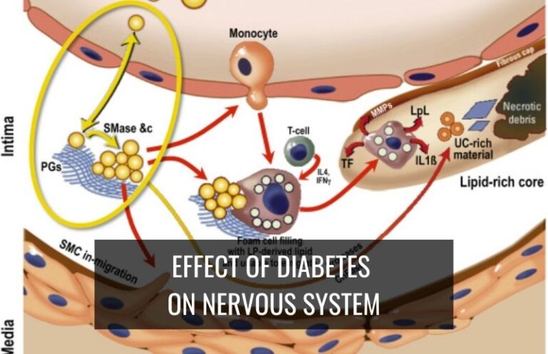 Effect of diabetes on nervous system