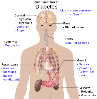 Effects of diabetes on various body systems
