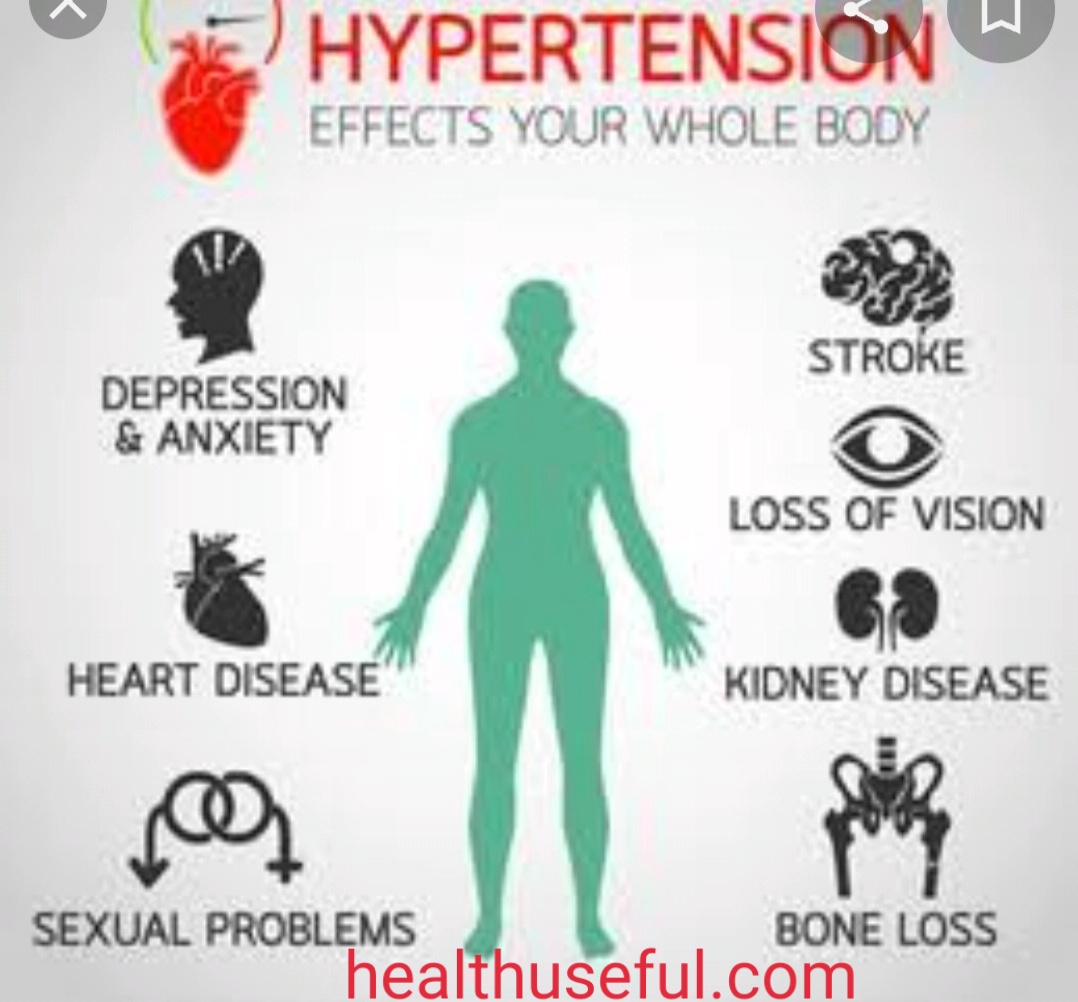 Hypertension-Eitiology of Hypertension