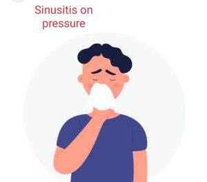 Sinusitis On Pressure